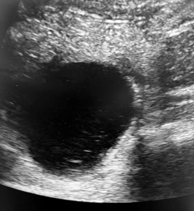 Recognizing and Managing Obstructive Urolithiasis in Small Ruminants